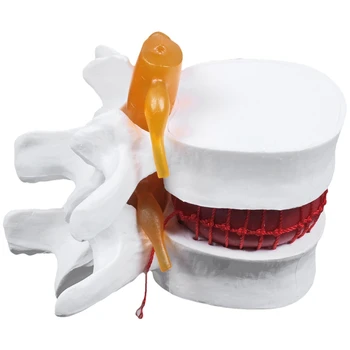 Človeška Anatomija Kosti Hrbtenice, Ledveni Disk Herniation Poučevanja Model Možganov, Lobanje Travmatičnih Šolske Potrebščine Instrume